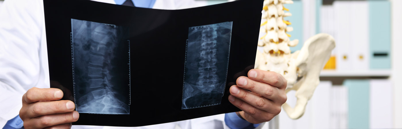 doctor holding x-ray of spine