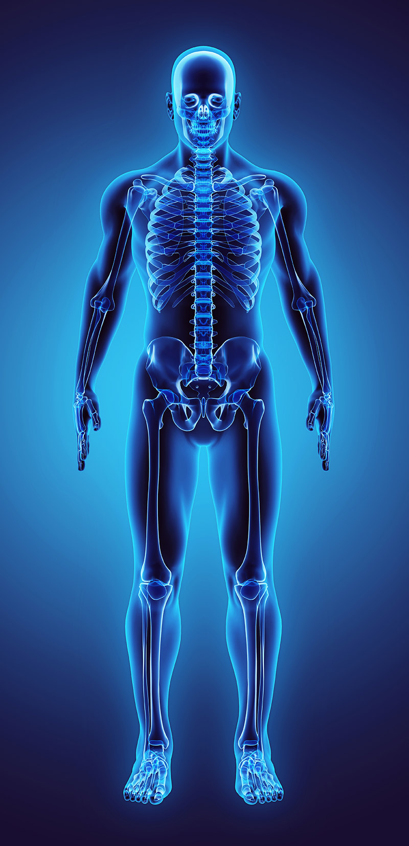 full body x-ray image