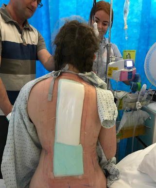 plaster on back